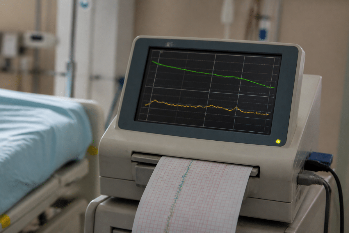 Moniteur fetal affichant frequence cardiaque fœtale diminuee